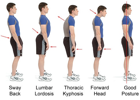 Low Back Pain and Hip Pain