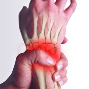 Repetitive Sprain Injury (RSI) and Tennis Elbow